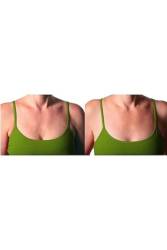 Göğüs Arası Kırışıklığı Giderici Yastık - Thumbnail